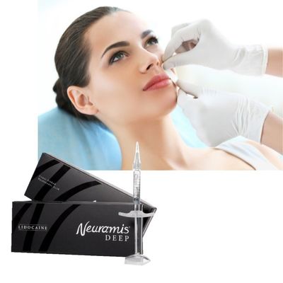 1 ml Neuramis Dermal Filler Yüzün Derinliklerine Yüzeysel Tedavi İçin