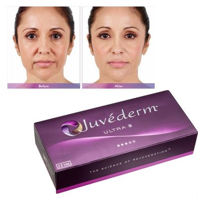 Hyaluronik Asit Juvederm Yüz Doldurucu Jeli Yumuşak ve Kusursuz Cilt