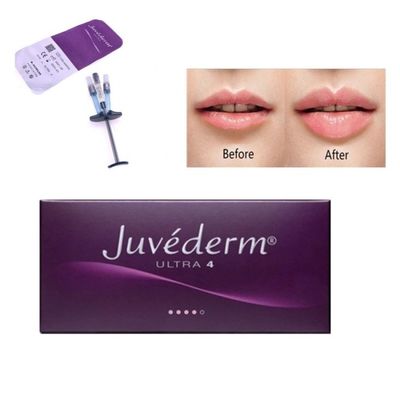 Juvederm Hyaluronik Asit Dermal Filler Ultra Voluma 2×1ml