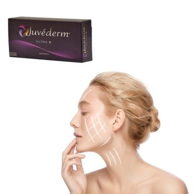 Karışıklığı Doldurmak İçin Hyaluronik Asit Dermal Dolgu Jeli - Juvederm Çözümü