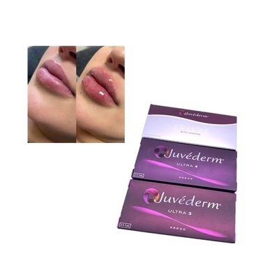 Enjeksiyon için Juvederm Voluma Cross Linked Dermal Filler