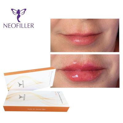 24mg-ml 2ml Şırınga Dermal Hyaluronik Asit Dermal Dolgu Enjekte edilebilir Gel Yüz Yenilenmesi Artırıcı