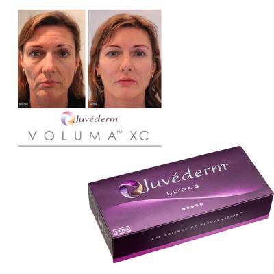 Kıvrım Düzeltme Juvederm Dermal Filler Hyaluronik Asit Enjekte edilebilir Gel Uzun Süren Yumuşatıcı Tedavi
