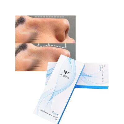 Çapraz Bağlı 2ml Hiyaluronik Asit Dermal Dolgu Deep Line Burnun Konturu Enjekte edilebilir Gel Yüz Büyütme
