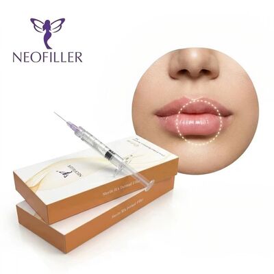 Neofiller Hyaluronik Asit Dermal Filler Yüz Dudakları Burnun Yanak Enjekte edilebilir Gel 2-25 Sarsılık Depolama Solüsyonu