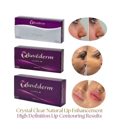 Şırınganın Hacmı 2 Kutu başına 1 ml Juvederm Hacmı Dolgucu Güvenlik Yüz Kontürü Hacmı Artıran Enjekte edilebilir Dermal Dolgucu