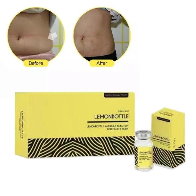 Yüksek Konsantrasyonlu Limon Şişe Solüsyonu Yağ Düzeltme Enjeksiyonları İçin 5 Flakon X 10ml Tüm Vücut